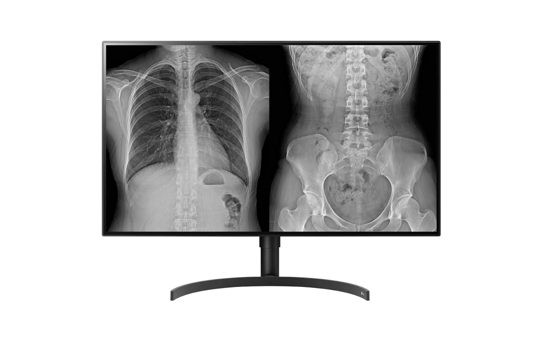 LG Монитор 27'' UHD 4K Ergo IPS LG 27UN880-B | USB Type-C ™, 27UN880-B